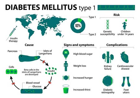 diabetes-mellitus-chart-730