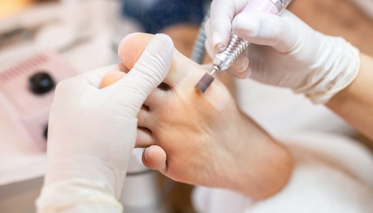 Foot pedicure treatment,  big toe skin area