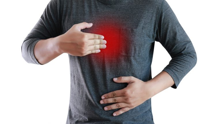 MAN with symptomatic acid reflux , suffering from acid reflux