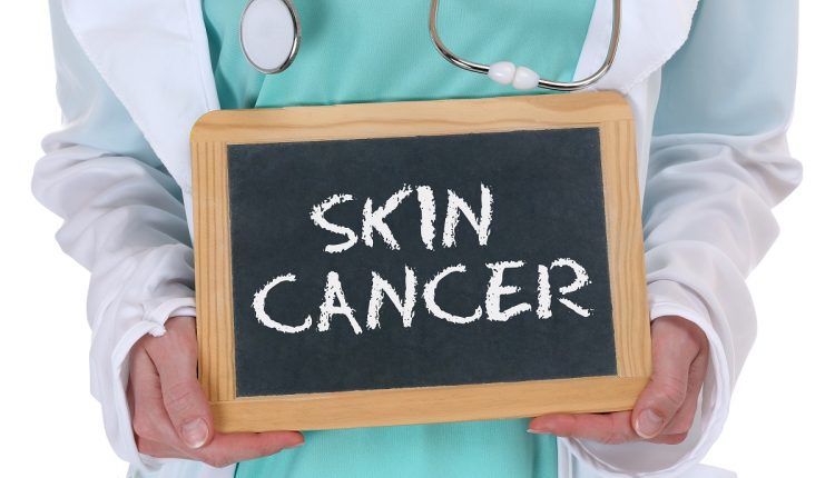 اختبار سرطان الجلد