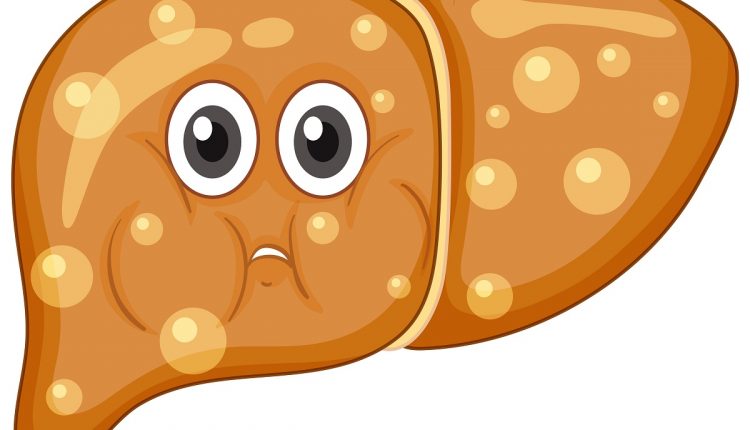 Fat Liver with face expression on white background