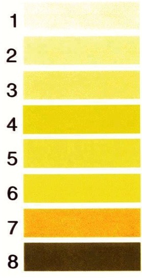 البول والماء 1-ifarasha