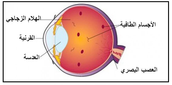 الأجسام الطائرة في العين