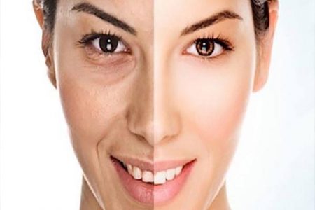 تزعجكِ هالات العيون السوداء؟ 5 طرق لتتخلصي منها في أسبوع واحد