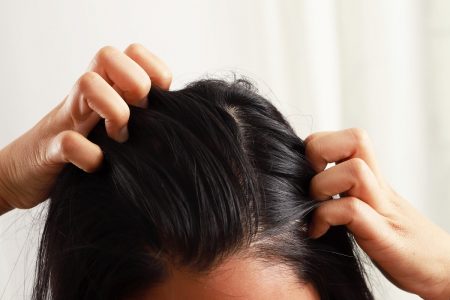 وصفات سريعة للتخلص من الشعر المدهن