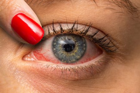 جفاف العينين : 10 نصائح بسيطة وطبيعية مفيدة جداً ! (  1 )