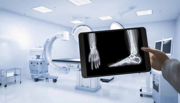 X-ray film diagnosis
