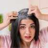 الشيب المبكر